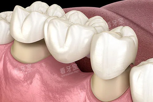 ��������ʾ��ͼ