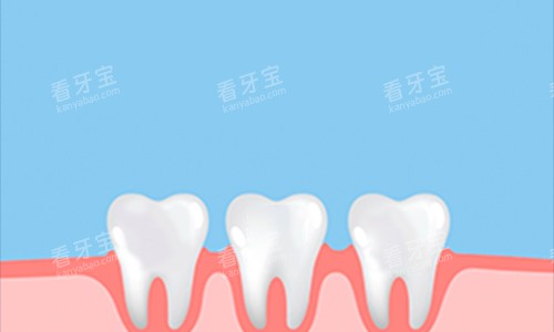 牙齿动画展示图 牙齿动画展示图