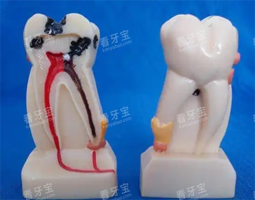 牙齿结构图解 牙齿结构图解