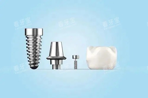 ��ֲ����ͬ����ģ��ʾ��ͼ