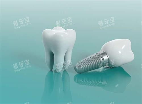 ��ֲ��ģ��ʾ��ͼ