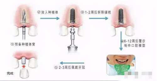 ��ֲ����6������ͼ��