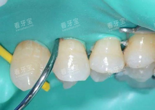 ��Ƥ���ڲ����е�����