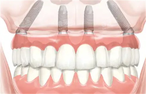 ��ֲ��͸��ͼ