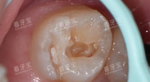 ��������ͼ����