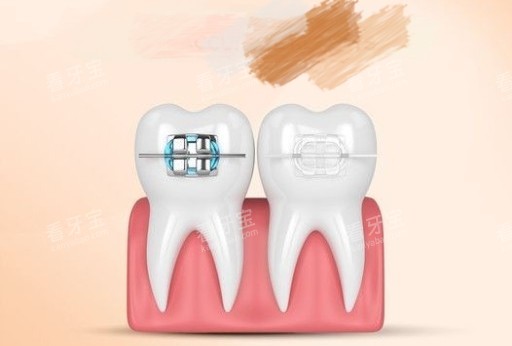 ���ݽ����������մ��в�����ͼ