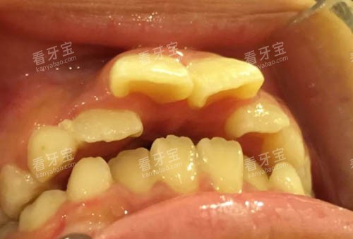 ������ͻ��Ƭ