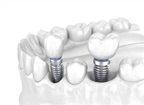 ��ֲ��ͼƬģ��