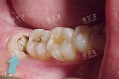 �ǳݸ�ʴʣһ��ʾ��ͼ