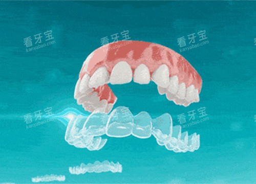 ���ν�����ͨʾ��ͼ