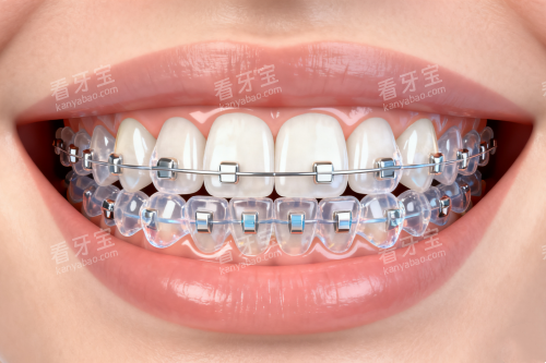 �մɰ����ν�����ͼƬһ��