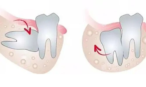 �ǳ�����