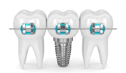 ��ֲ�����ݽ���ͼƬ