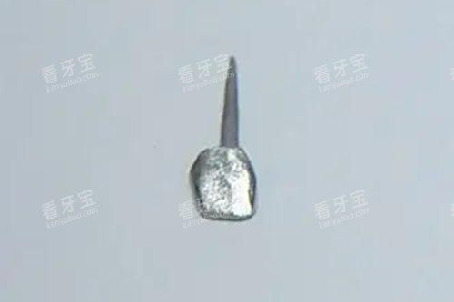 牙齿金属桩.webp 牙齿金属桩.webp