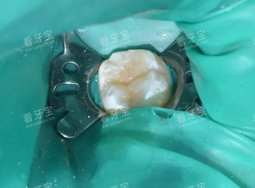 ��������ͼ