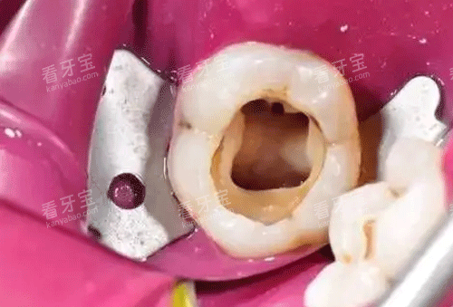 ���ݸ�������ͼƬ