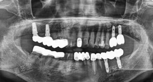 ���������ֲct