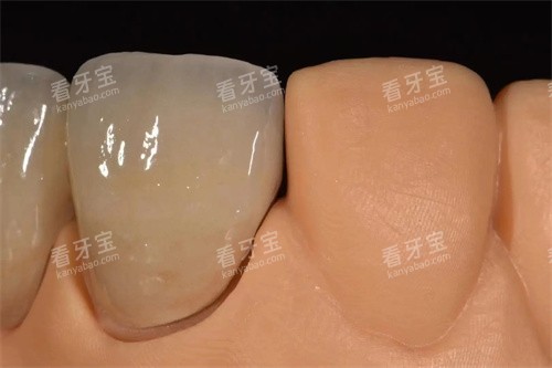 ���΢���۸����