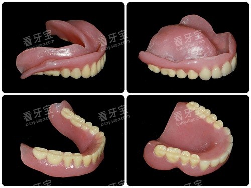 全口吸附性义齿实物展示图 全口吸附性义齿实物展示图