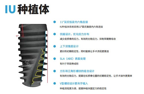 韩国沃兰种植牙怎么样 韩国沃兰种植牙怎么样