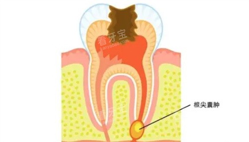 ʲô�Ǹ�������