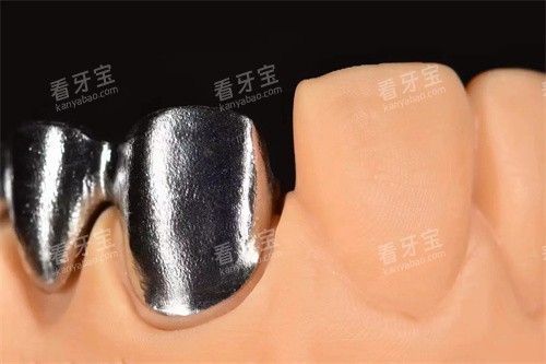 义佳微纳熔覆义齿实物图 义佳微纳熔覆义齿实物图