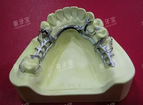 义齿钢托细节图 义齿钢托细节图