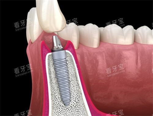 ��ֲ������ͼ