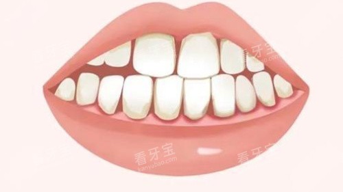 牙周炎卡通 牙周炎卡通