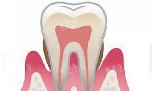 中午牙周炎展示 中午牙周炎展示