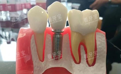 �Ƹ�������ǻ����ģ��ʵ��ͼ