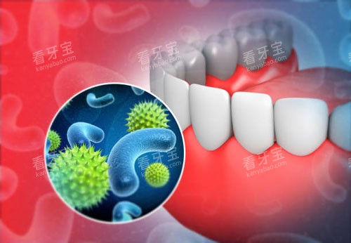 牙齿感染示意图 牙齿感染示意图