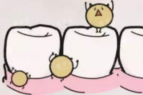 牙齿有细菌卡通图 牙齿有细菌卡通图