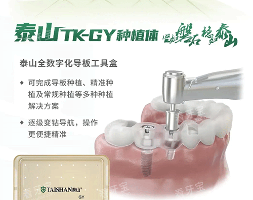 泰山种植牙怎么样 泰山种植牙怎么样