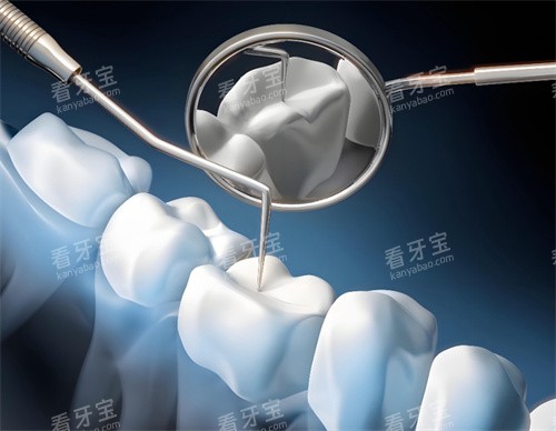 检查牙齿 检查牙齿