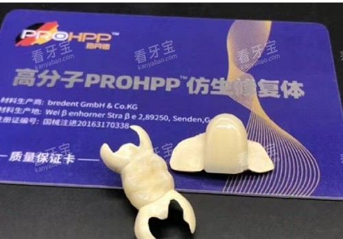 hpp粘接桥牙齿单颗示意图 hpp粘接桥牙齿单颗示意图