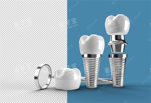 ��ֲ������ͼʾ