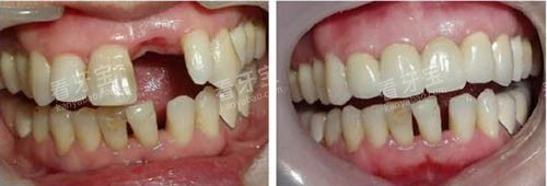 ��ֲ������ǰ��ͼ