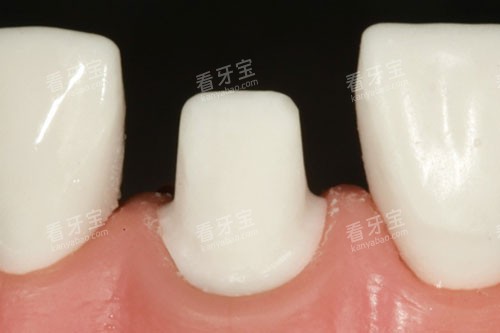 ��ĥ����ʾ��ͼ