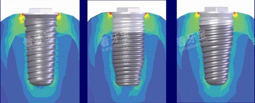 不同尺寸的植体照片 不同尺寸的植体照片