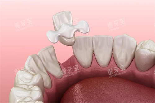 �������Ŷ���