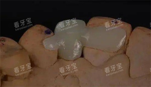 ��������ģ��