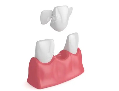 �������Ű�װ