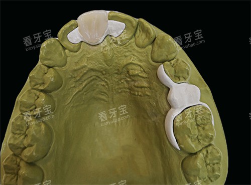 ���������޸�ģ��