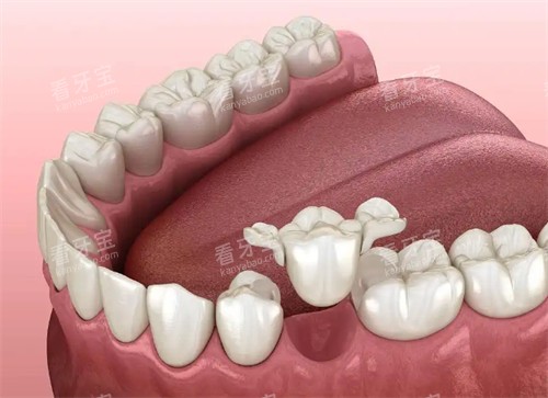 �������Ŷ���Ǯ