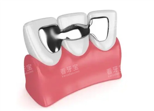 ����������ʲô