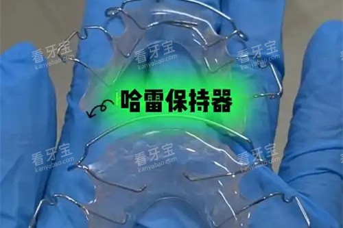 哈雷保持器 哈雷保持器