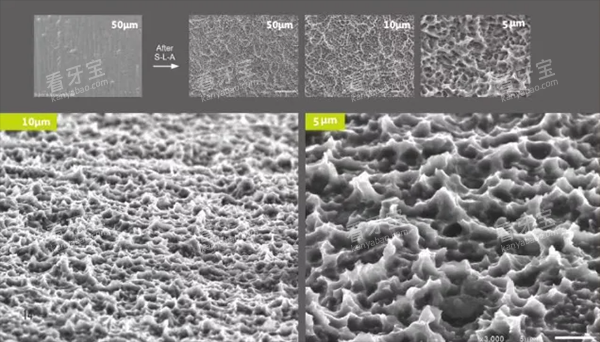 百康特种植牙设计优势 百康特种植牙设计优势