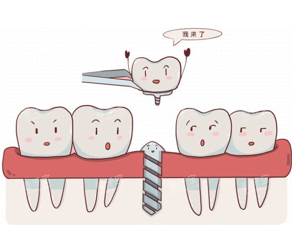 种植牙治疗卡通图 种植牙治疗卡通图