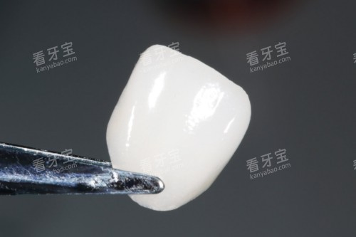 ���������չʾͼ